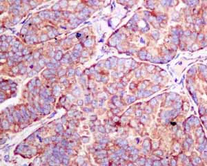 Immunohistochemistry (Formalin/PFA-fixed paraffin-embedded sections) - Anti-RPS10 antibody [EPR8545] - BSA and Azide free (AB238926)