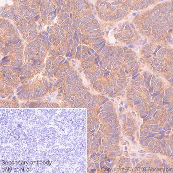 Immunohistochemistry (Formalin/PFA-fixed paraffin-embedded sections) - Anti-RPS10 antibody [EPR8545] - BSA and Azide free (AB238926)