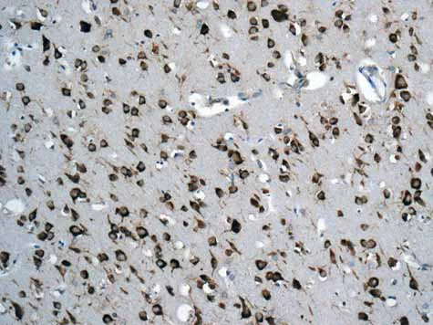 Immunohistochemistry (Formalin/PFA-fixed paraffin-embedded sections) - Anti-RPS12 antibody [EPR10964(B)] (AB167428)