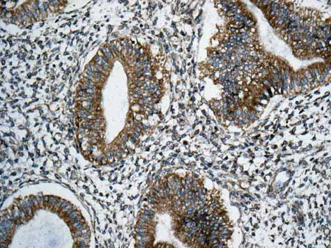 Immunohistochemistry (Formalin/PFA-fixed paraffin-embedded sections) - Anti-RPS12 antibody [EPR10964(B)] (AB167428)