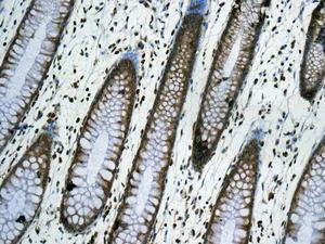 Immunohistochemistry (Formalin/PFA-fixed paraffin-embedded sections) - Anti-RPS12 antibody [EPR10964(B)] (AB167428)