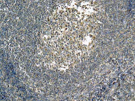 Immunohistochemistry (Formalin/PFA-fixed paraffin-embedded sections) - Anti-RPS12 antibody [EPR10964(B)] (AB167428)