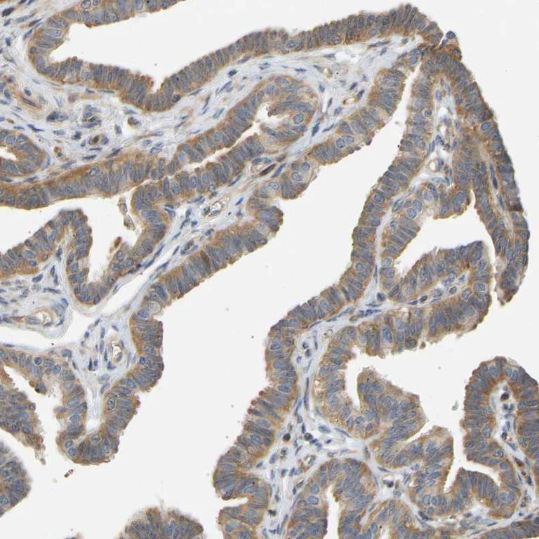 Immunohistochemistry (Formalin/PFA-fixed paraffin-embedded sections) - Anti-RPS14 antibody (AB246916)
