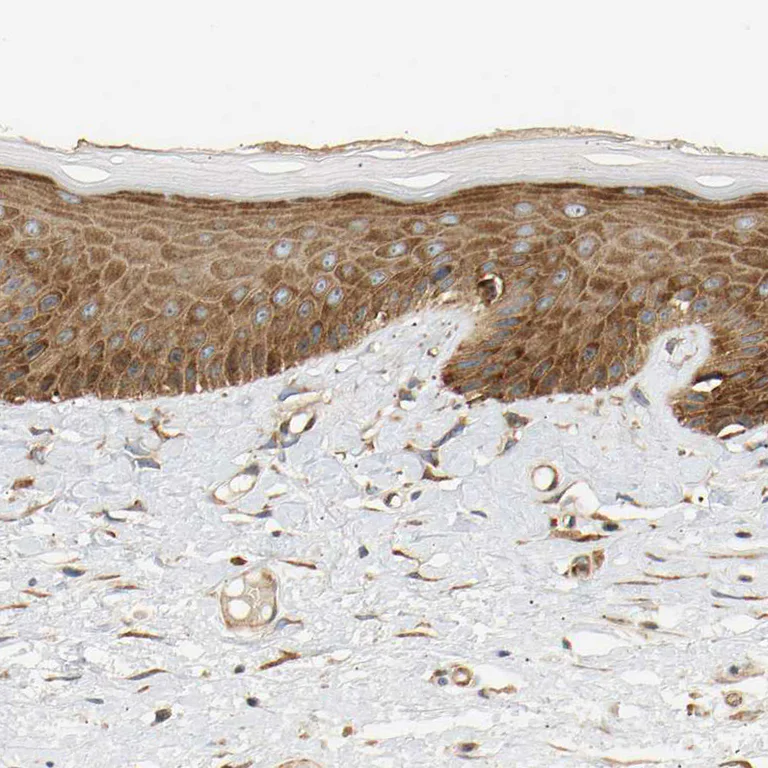Immunohistochemistry (Formalin/PFA-fixed paraffin-embedded sections) - Anti-RPS14 antibody (AB246916)