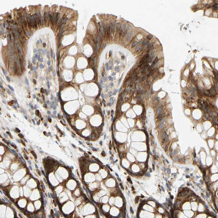 Immunohistochemistry (Formalin/PFA-fixed paraffin-embedded sections) - Anti-RPS14 antibody (AB246916)