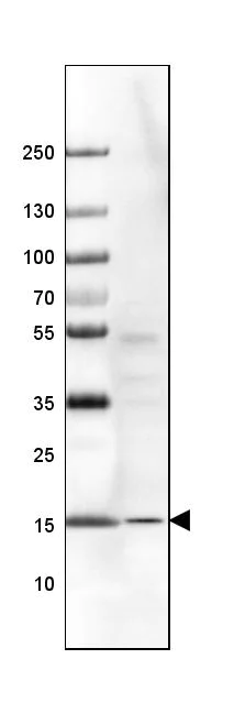 Western blot - Anti-RPS14 antibody (AB246916)