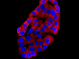 Immunocytochemistry/ Immunofluorescence - Anti-RPS15 antibody [EPR11104] (AB157193)