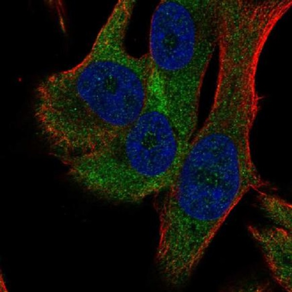Immunocytochemistry/ Immunofluorescence - Anti-RPS18 antibody (AB220708)
