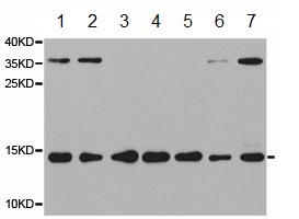 Western blot - Anti-RPS19 antibody (AB187197)
