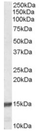 Western blot - Anti-RPS19 antibody (AB40833), expandable thumbnail