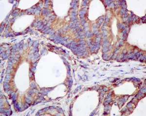 Immunohistochemistry (Formalin/PFA-fixed paraffin-embedded sections) - Anti-RPS19 antibody [EPR10423] (AB181365)