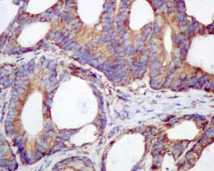 Immunohistochemistry (Formalin/PFA-fixed paraffin-embedded sections) - Anti-RPS19 antibody [EPR10423] - BSA and Azide free (AB250491)