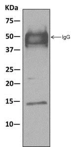 Immunoprecipitation - Anti-RPS19 antibody [EPR10423] - BSA and Azide free (AB250491)