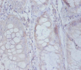 Immunohistochemistry (Formalin/PFA-fixed paraffin-embedded sections) - Anti-RPS19BP1/AROS antibody (AB236598)
