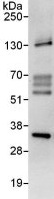 Immunoprecipitation - Anti-RPS2 antibody (AB137889)