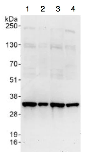 Western blot - Anti-RPS2 antibody (AB137889)