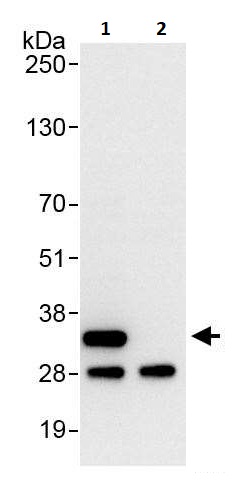 Immunoprecipitation - Anti-RPS2 antibody (AB264336)