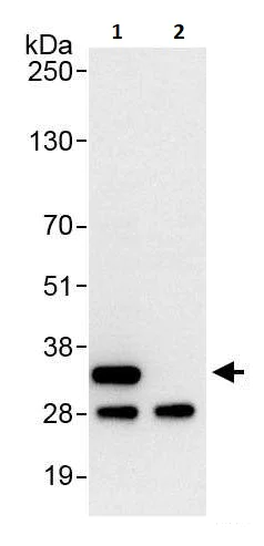 Immunoprecipitation - Anti-RPS2 antibody (AB264336)