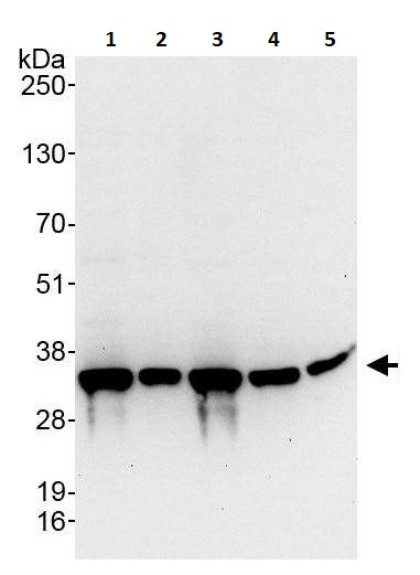 Western blot - Anti-RPS2 antibody (AB264336)