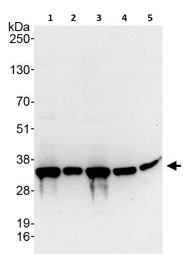 Western blot - Anti-RPS2 antibody (AB264336)