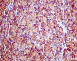 Immunohistochemistry (Formalin/PFA-fixed paraffin-embedded sections) - Anti-RPS2 antibody [EPR10834(B)] (AB155961)