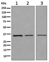 Western blot - Anti-RPS2 antibody [EPR10834(B)] (AB155961)