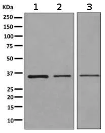 Western blot - Anti-RPS2 antibody [EPR10834(B)] (AB155961)
