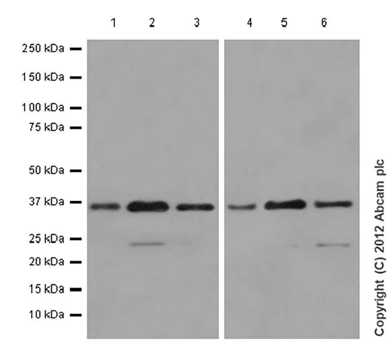 Western blot - Anti-RPS2 antibody [EPR10834(B)] - BSA and Azide free (AB249215)