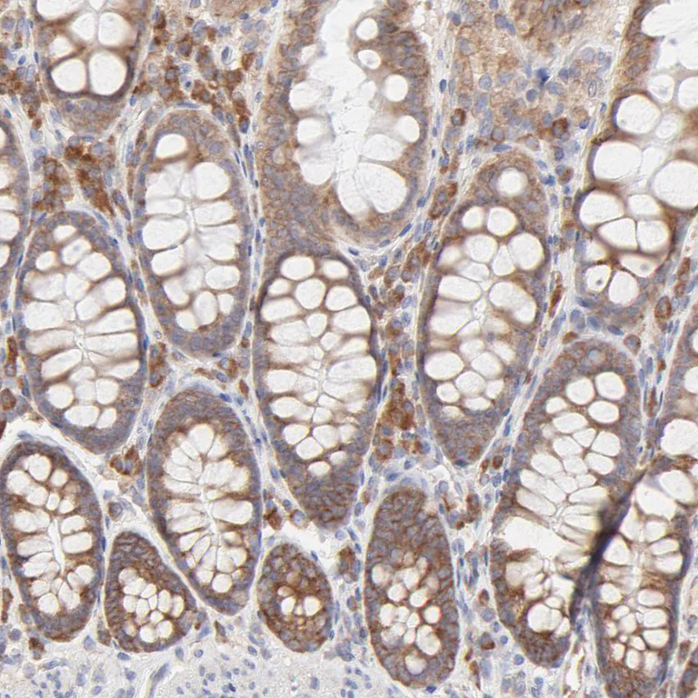Immunohistochemistry (Formalin/PFA-fixed paraffin-embedded sections) - Anti-RPS21 antibody (AB254670)