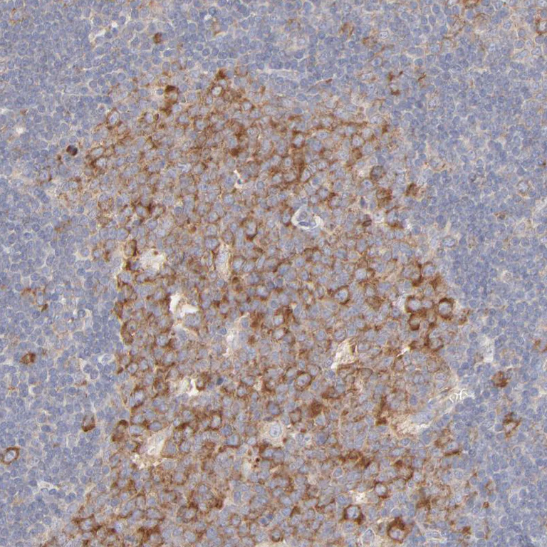 Immunohistochemistry (Formalin/PFA-fixed paraffin-embedded sections) - Anti-RPS21 antibody (AB254670)