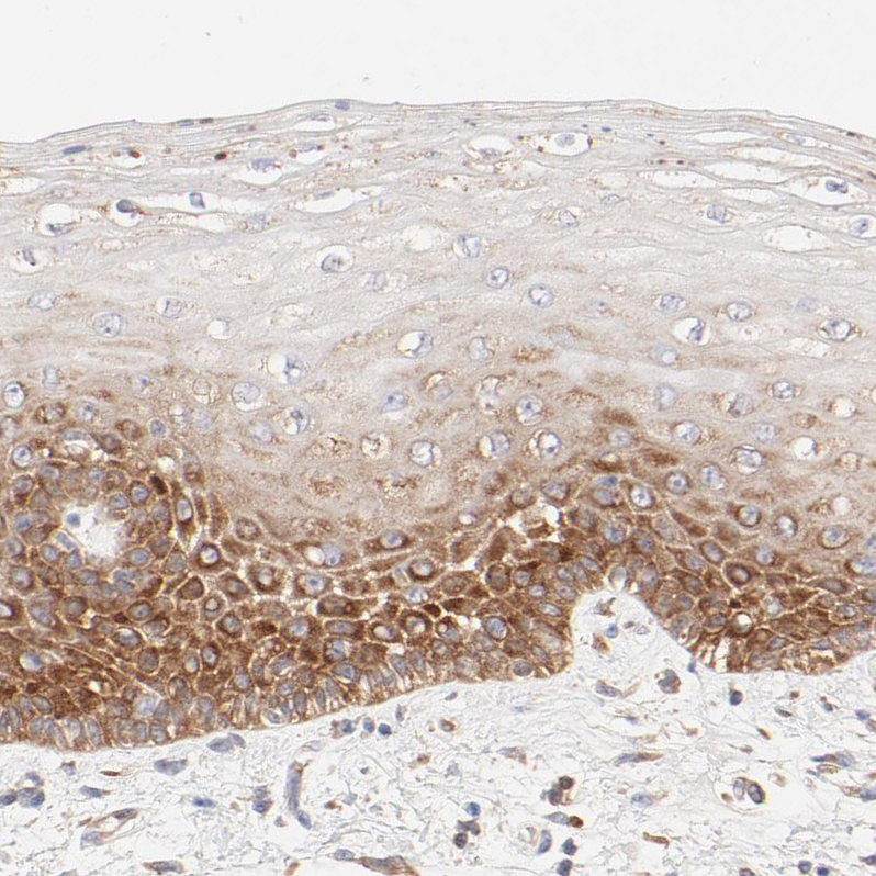 Immunohistochemistry (Formalin/PFA-fixed paraffin-embedded sections) - Anti-RPS21 antibody (AB254670)