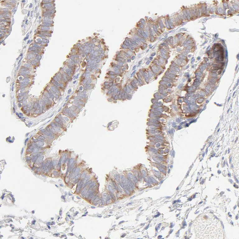 Immunohistochemistry (Formalin/PFA-fixed paraffin-embedded sections) - Anti-RPS21 antibody (AB254670)