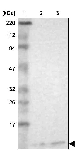 Western blot - Anti-RPS21 antibody (AB254670)