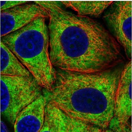 Immunocytochemistry/ Immunofluorescence - Anti-RPS23 antibody (AB185372)
