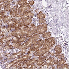 Immunohistochemistry (Formalin/PFA-fixed paraffin-embedded sections) - Anti-RPS23 antibody (AB185372)