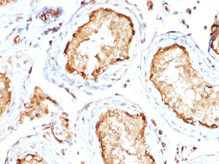 Immunohistochemistry (Formalin/PFA-fixed paraffin-embedded sections) - Anti-RPS23 antibody [CPTC-YWHAE-1] (AB268130), expandable thumbnail