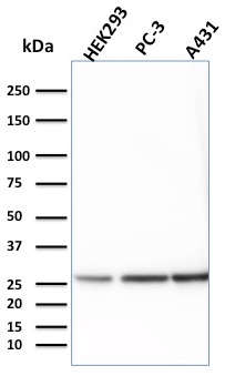 Western blot - Anti-RPS23 antibody [CPTC-YWHAE-1] (AB268130), expandable thumbnail