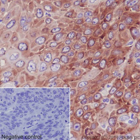 Immunohistochemistry (Formalin/PFA-fixed paraffin-embedded sections) - Anti-RPS24 antibody [EPR16017(B)] (AB196652)