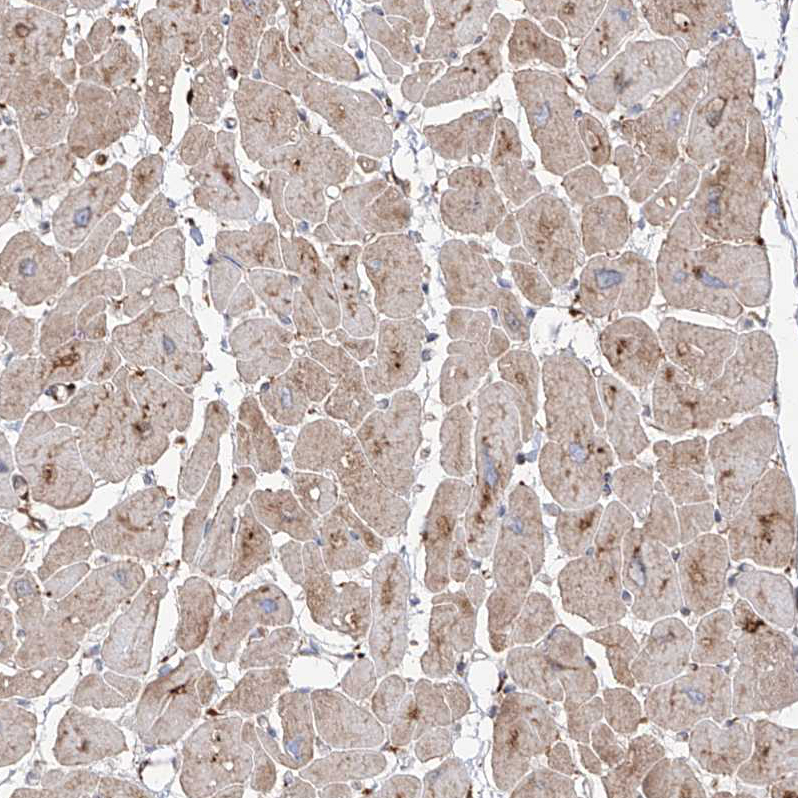 Immunohistochemistry (Formalin/PFA-fixed paraffin-embedded sections) - Anti-RPS25 antibody (AB254671)