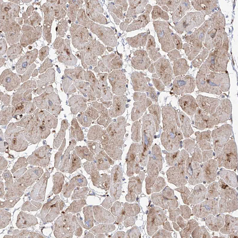 Immunohistochemistry (Formalin/PFA-fixed paraffin-embedded sections) - Anti-RPS25 antibody (AB254671)