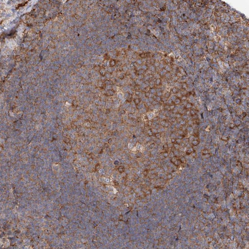 Immunohistochemistry (Formalin/PFA-fixed paraffin-embedded sections) - Anti-RPS25 antibody (AB254671)