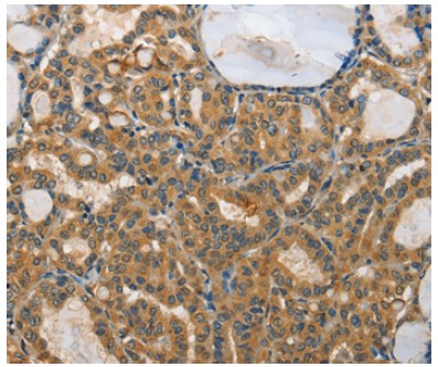 Immunohistochemistry (Formalin/PFA-fixed paraffin-embedded sections) - Anti-RPS27/MPS1 antibody (AB197382)