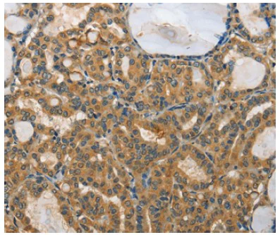 Immunohistochemistry (Formalin/PFA-fixed paraffin-embedded sections) - Anti-RPS27/MPS1 antibody (AB197382)