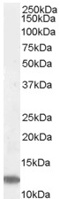 Western blot - Anti-RPS27/MPS1 antibody (AB4385)
