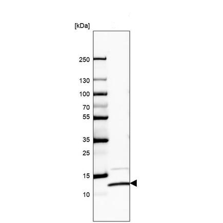 Western blot - Anti-RPS27/MPS1 + RPS27L antibody (AB221904)
