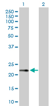Western blot - Anti-RPS27A antibody (AB172293)