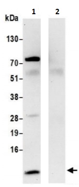 Immunoprecipitation - Anti-RPS28 antibody (AB241282)