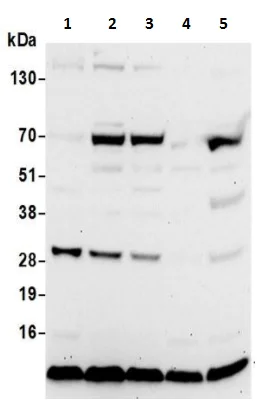 Western blot - Anti-RPS28 antibody (AB241282)