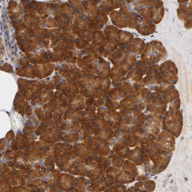 Immunohistochemistry (Formalin/PFA-fixed paraffin-embedded sections) - Anti-RPS29 antibody (AB254638)