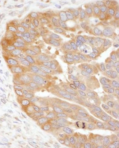 Immunohistochemistry (Formalin/PFA-fixed paraffin-embedded sections) - Anti-RPS3 antibody (AB140688)